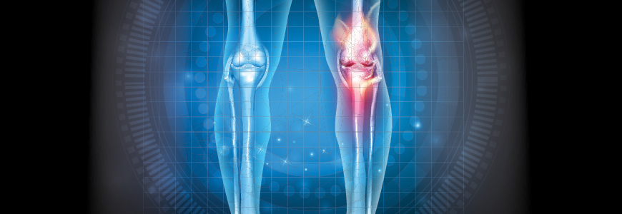 Illustration of knee