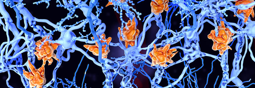Microglia cells damage the myelin sheath of neuron axons