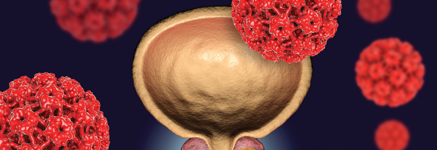 Illustration of cancer cell in prostate