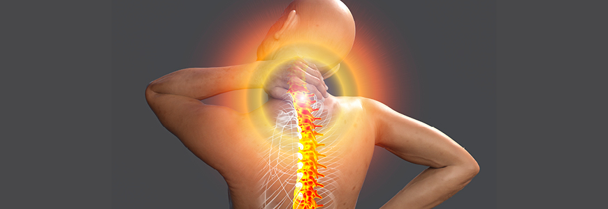 Illustration of nerve spine pain 