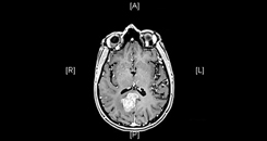 preoperative imaging