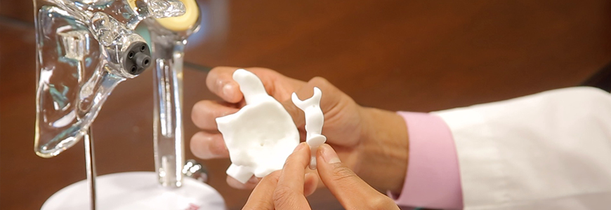 3-D printed scapula and patient-specific guide