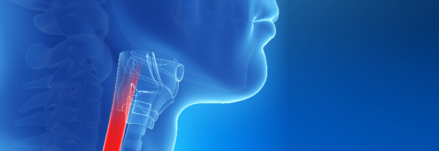 3-D illustration of throat from the side