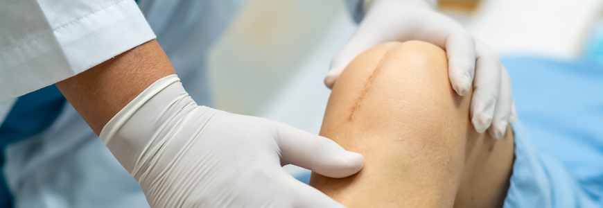 Physician looking at patient's knee that has a surgical incision