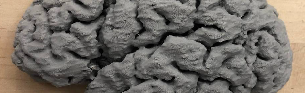 3D Reconstruction of pediatric brain