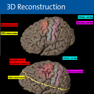 3D Reconstruction