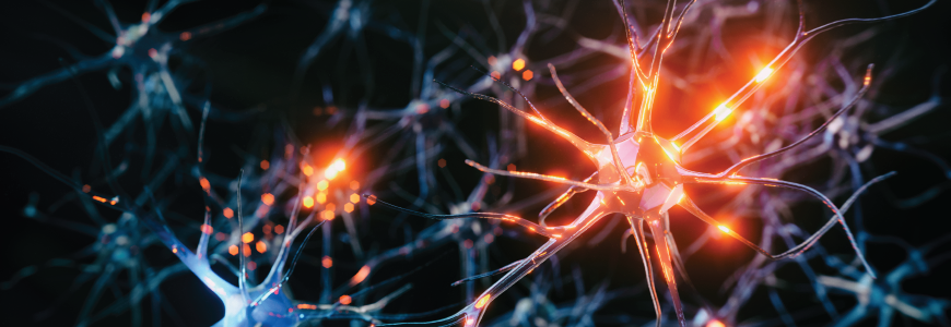 Illustration of stroke in the brain
