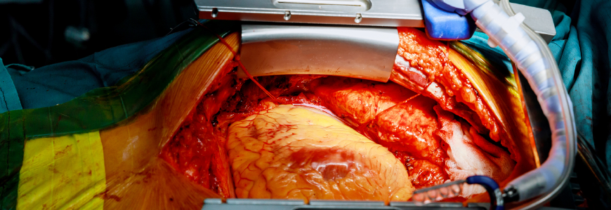 View of the heart inside the chest cavity