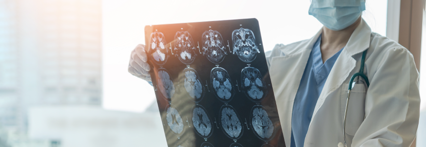 Medical doctor seeing Magnetic Resonance Imaging (MRI)