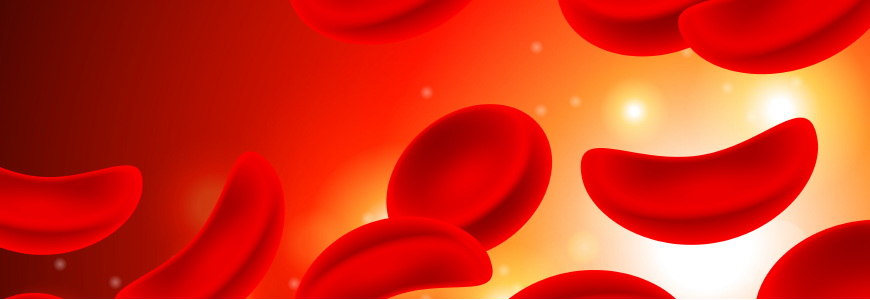Sickle Cell Anemia Red cells in Blood Stream