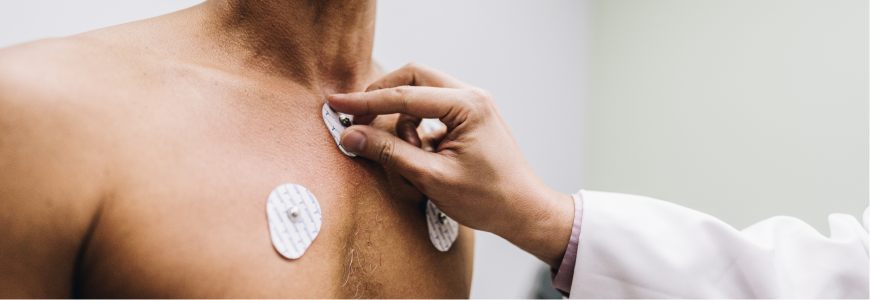 Close-up of human hands putting sensors of electrocardiography on a doctor's office