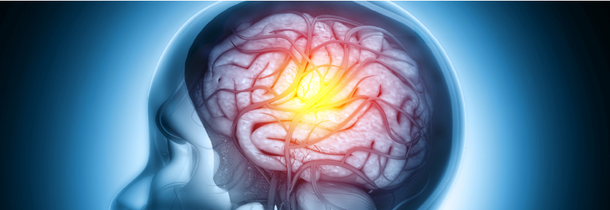Human brain injury,damage,hemorrhage