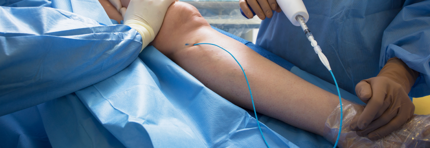 Doctors doing vein surgery procedure