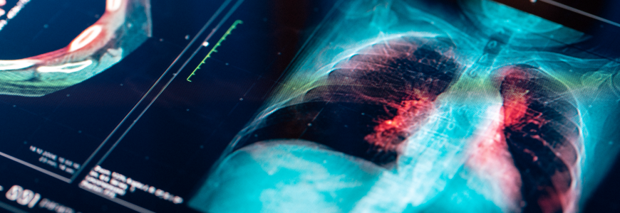 Medical MRI Scan on digital screen