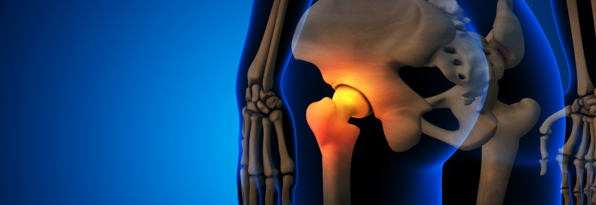 Skeleton with osteoarthritis hip joint pain