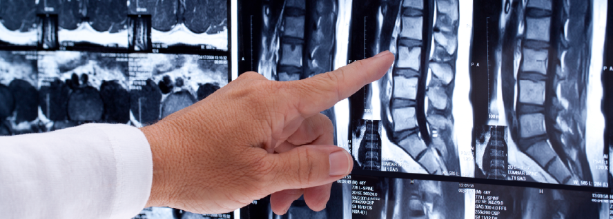 MRI scan of human lumbar spine with doctor