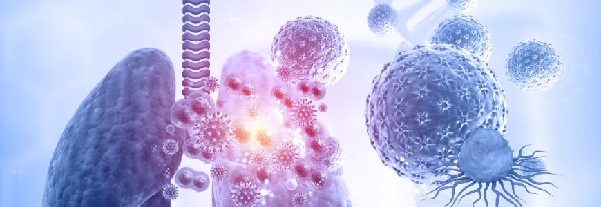 Human lungs cancer concept featuring malignant cells, viruses, bacteria, DNA strands, inflammation, respiratory damage, dramatic scientific lighting.