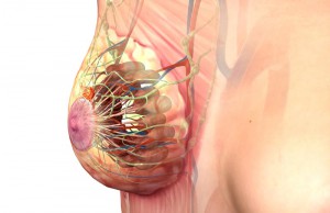 Double mastectomy 'does not reduce mortality' for unilateral