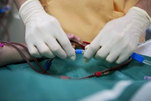 Patient with an arteriovenous fistula for hemodialysis at Laennec hospital in Creil, France.