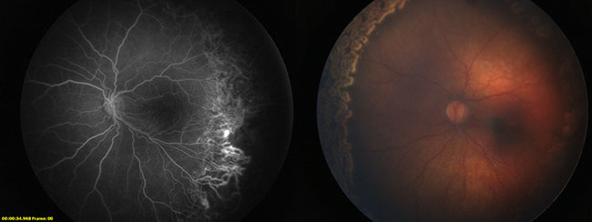 CPT_Issue50_Ophthalmology_Figure 3article