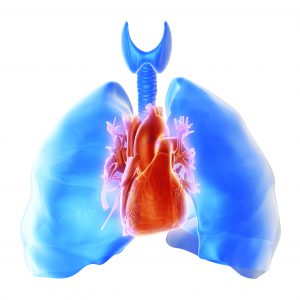 Pulmonary hypertension, computer artwork. Pulmonary hypertension is a term to describe a disease in which the blood pressure in the lungs (pulmonary artery system) is higher than normal. Pulmonary hypertension results when the blood vessels constrict (tightens). Over time this constriction causes fibrosis (scars) of the vessel and higher pulmonary blood pressure. The chambers on the right side of the heart have difficulty pumping blood out to the pulmonary artery and through the lungs. The strain on the heart to overcome this high pressure and constriction causes the heart to become enlarged and weak. For artistic purposes, the heart in this image is positioned in front of the lungs, instead of it