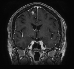 CPT_Issue52_Neurology_Figure2