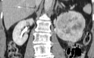 CPT_Online_Issue63_Oncology_Case_Fig1