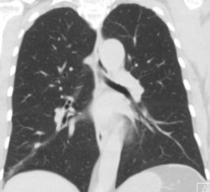 CPT_Online_Issue63_Oncology_Case_Fig3