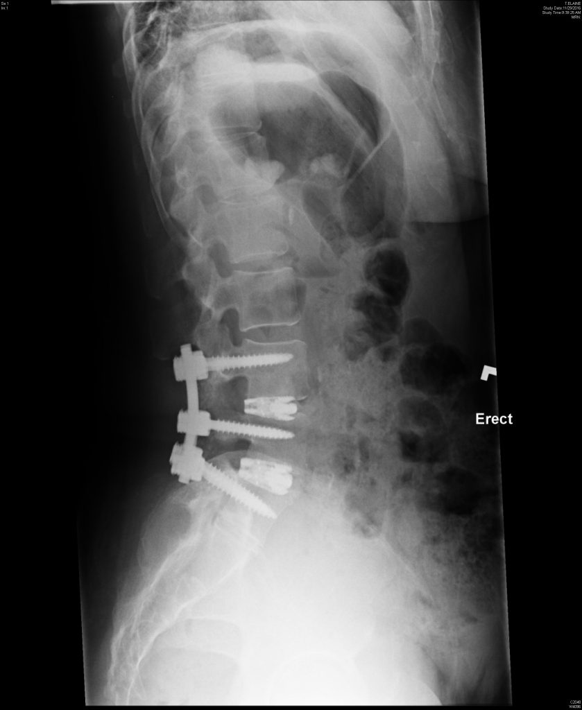 CPT_Online_Issue63_Orthopaedics_Case_Fig2