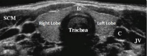 CPT_Online_Issue69_Endocrinology_Case