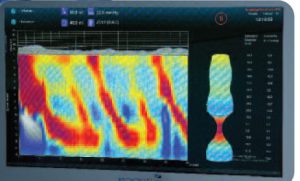 Diagnosing-Dysphagia-and-Chest-Pain