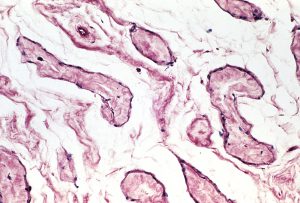 How-to-Interpret-Discordant-Results-From-the-RSA-Screening-Method-for-Syphilis