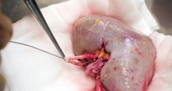 Image of kidney