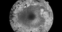 Developing Gene-Specific Molecular Approaches to Treat Inherited Retinal Diseases