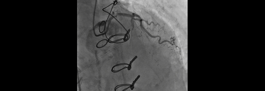 xray