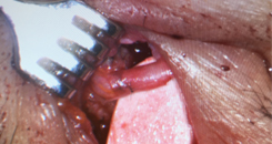 Select Findings from AAO 2018