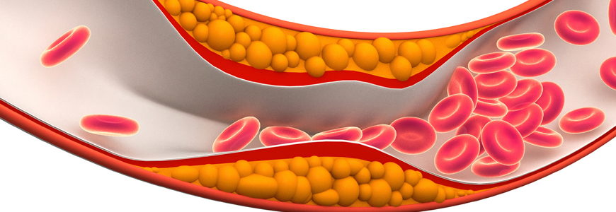 cholesterol in the blood stream