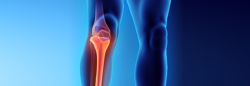 Illustration of knee