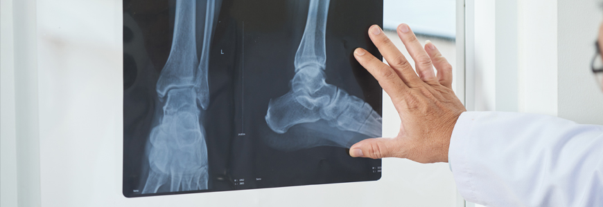 Doctor looking at xray