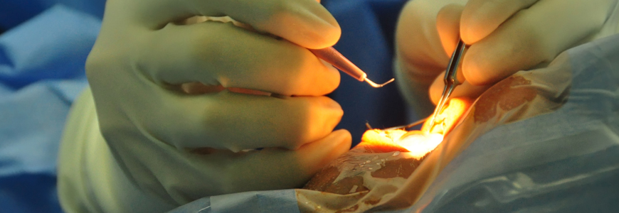 close up of physician's hands during an eye surgery