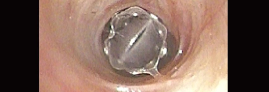 photo of valve