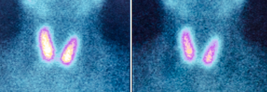 Thyroid imagery