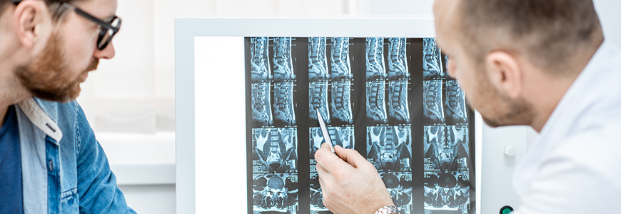Radiographs of spinal deformity