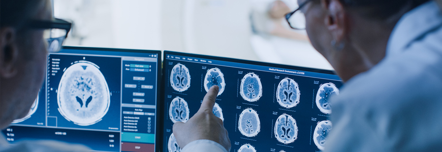 Doctors reviewing brain radiographs