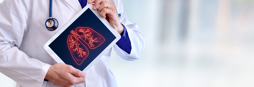 Lung image