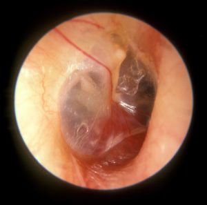 File:Mandibular Nerve.jpg - Wikimedia Commons