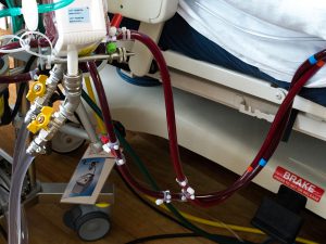 New-ECMO-Protocols-for-ARDS-Management-Implemented-by-Duke-Pulmonologists
