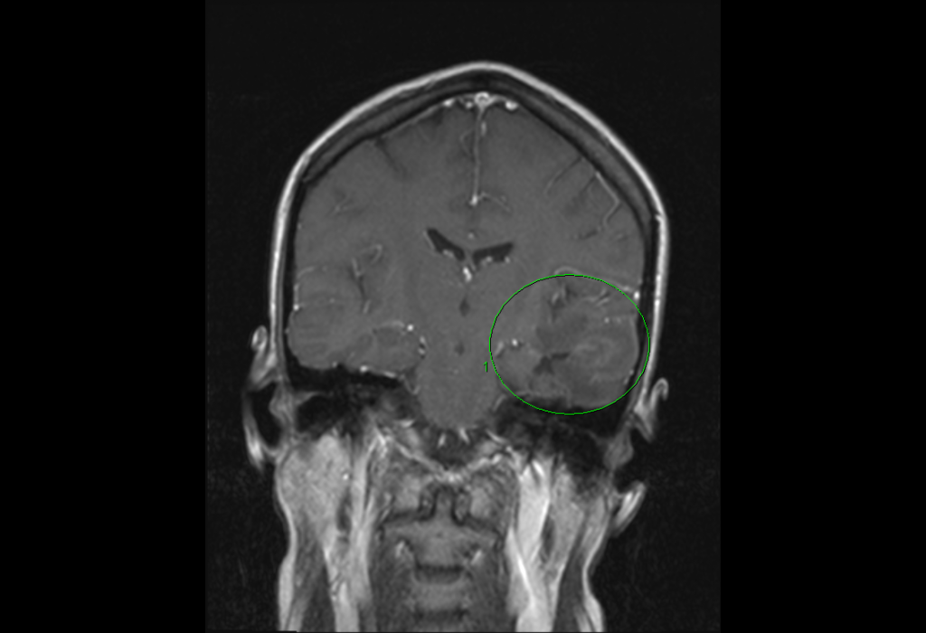 oncology-quickcase-fig1