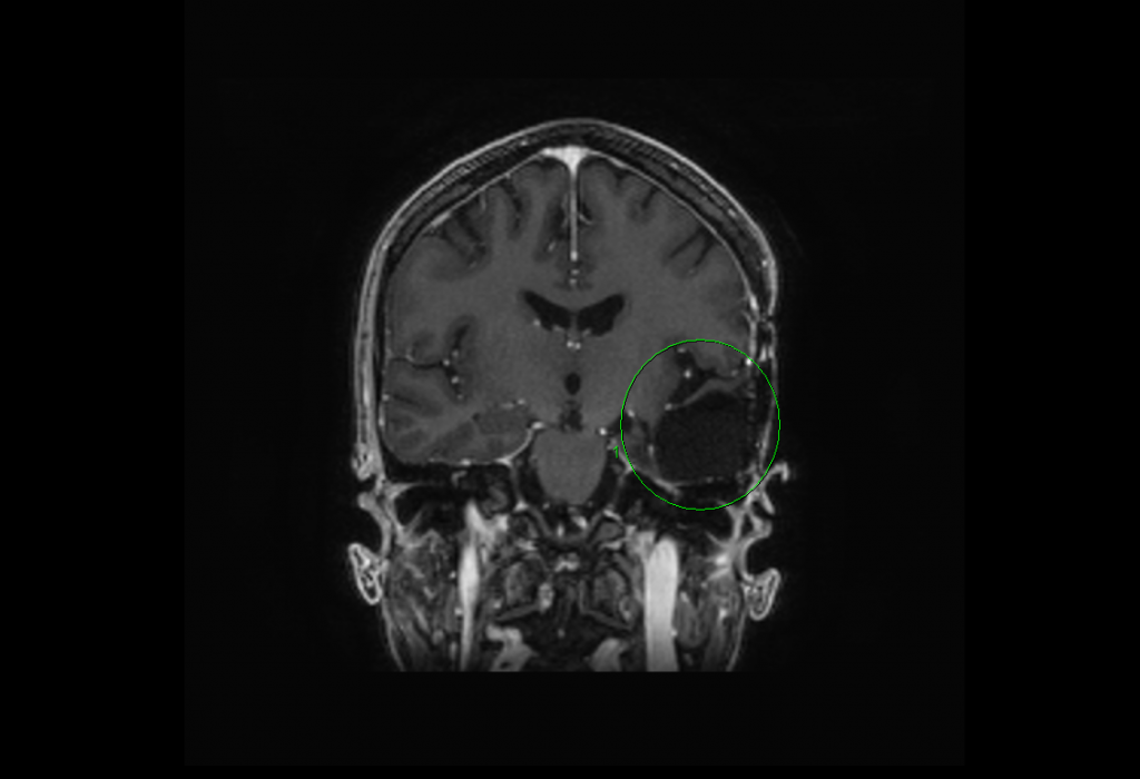 oncology-quickcase-fig2