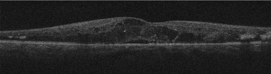 Optical coherence tomography image captured using a remote diagnosis imaging device